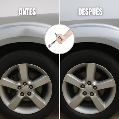 Autofix: Kit Profesional de Reparación de Abolladuras para Coche